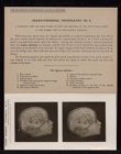 Cranio-Cerebral Topography - no. 8
